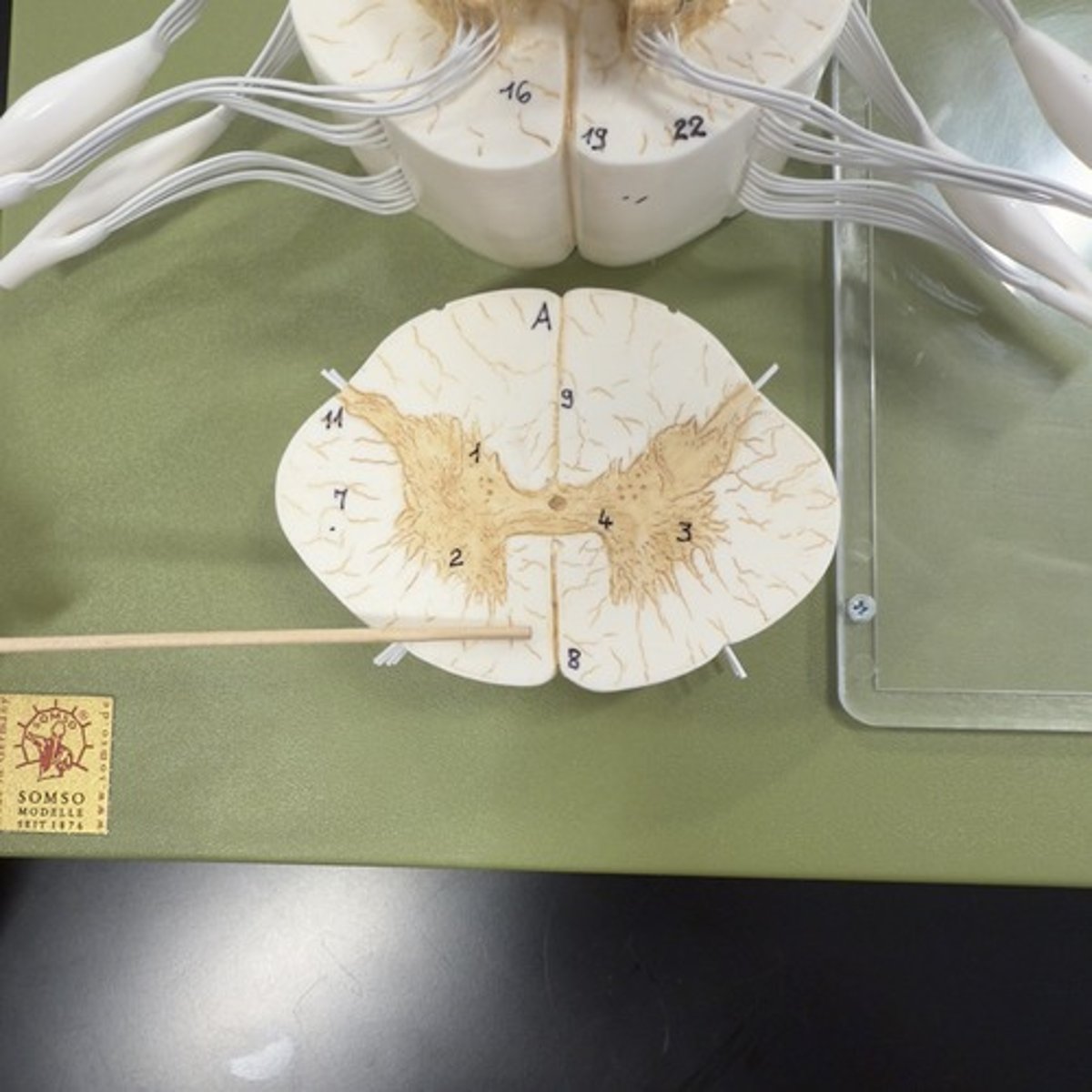 <p>Identify the structure.</p>