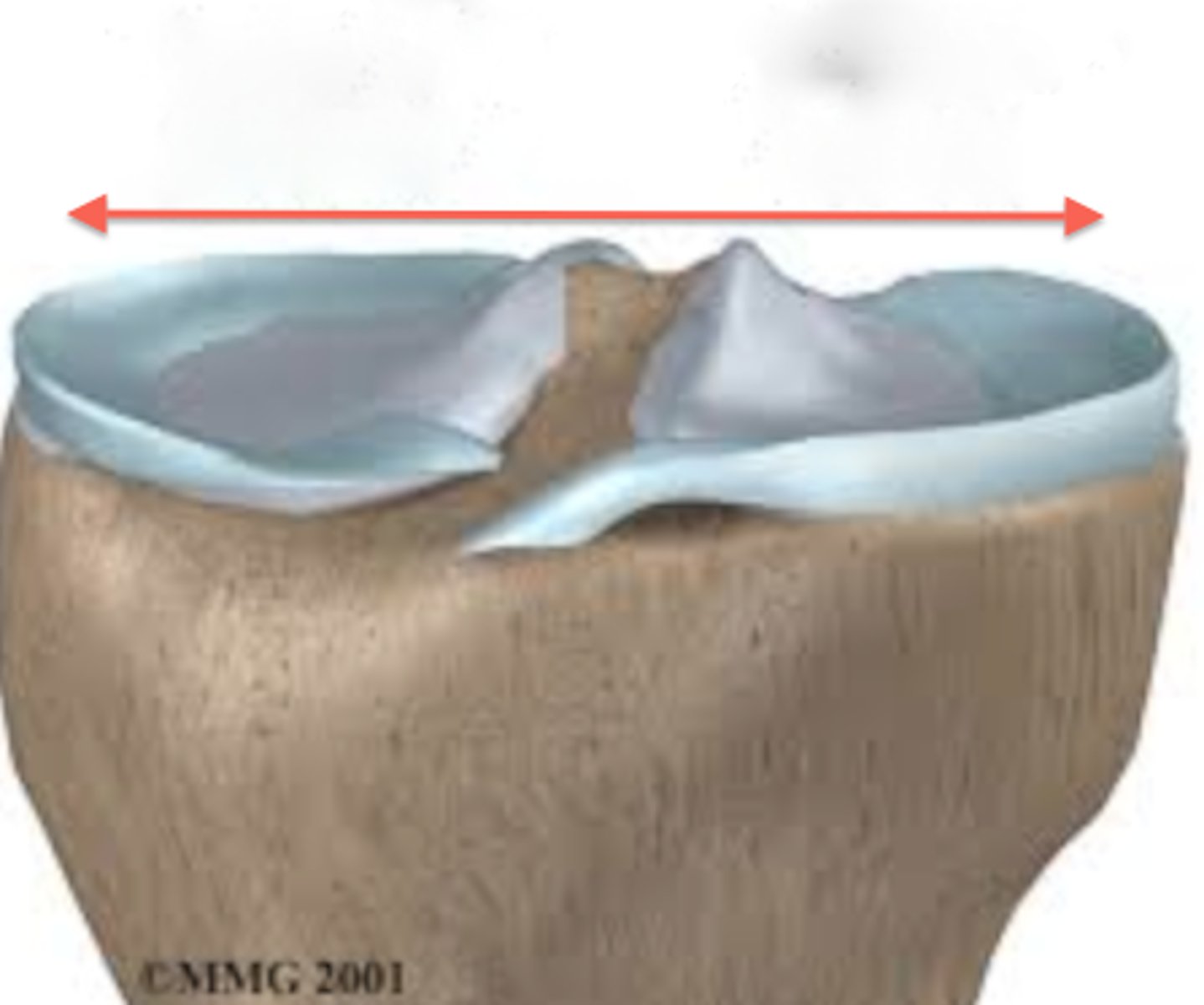 <p>The flat portion of the tibia that articulates with the femur</p>
