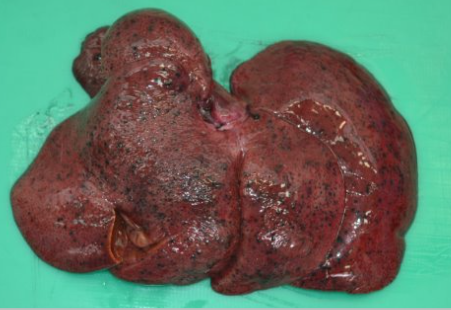 <p>Name the organ. Describe the distribution. Diagnosis. </p>