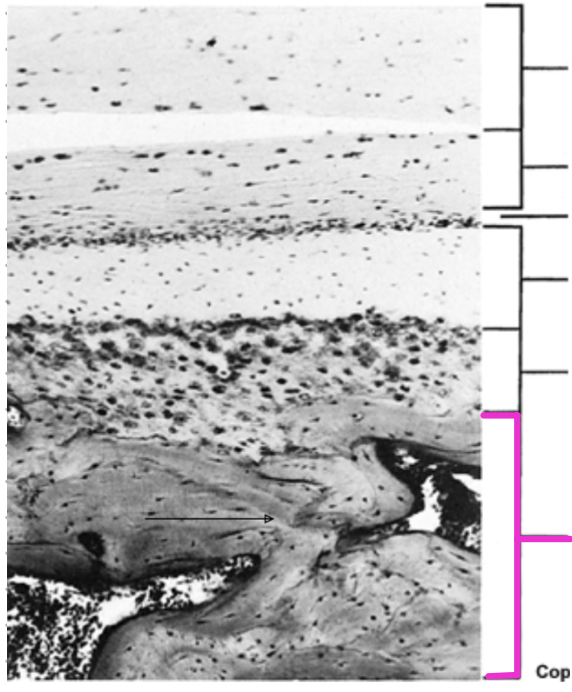 <p>Identify the histological structure of the adult mandibular condyle</p>