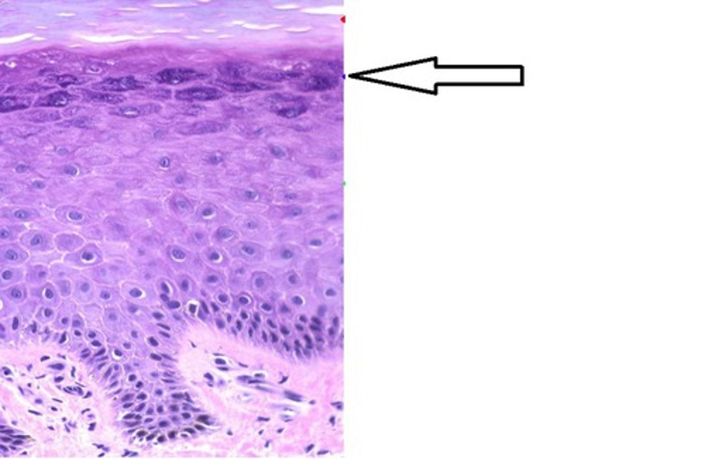 <p>a layer of the epidermis that marks the transition between the deeper, metabolically active strata and the dead cells of the more superficial strata</p>