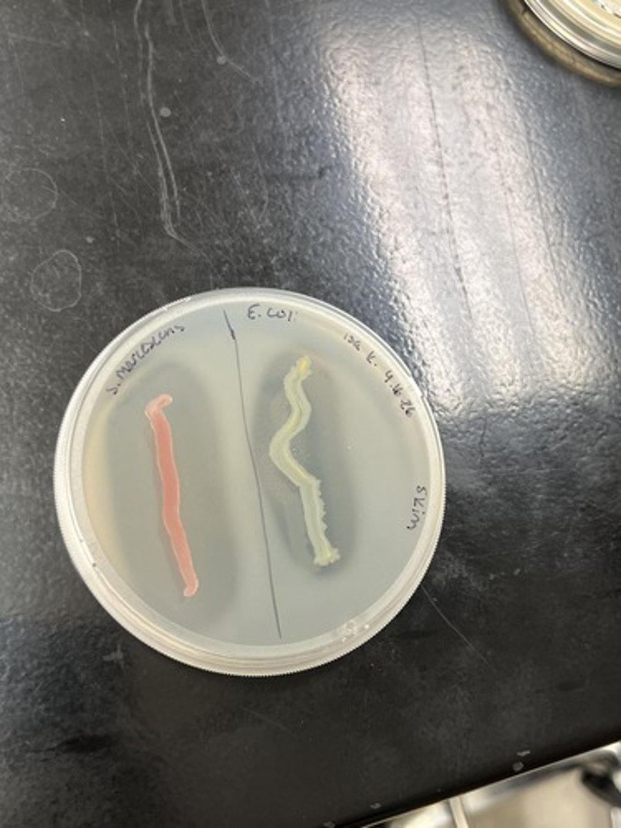 <p>Tests for organisms ability to use casienase to break down casein.</p><p>Casein hydrolysis (+) - Clearing around organism</p>