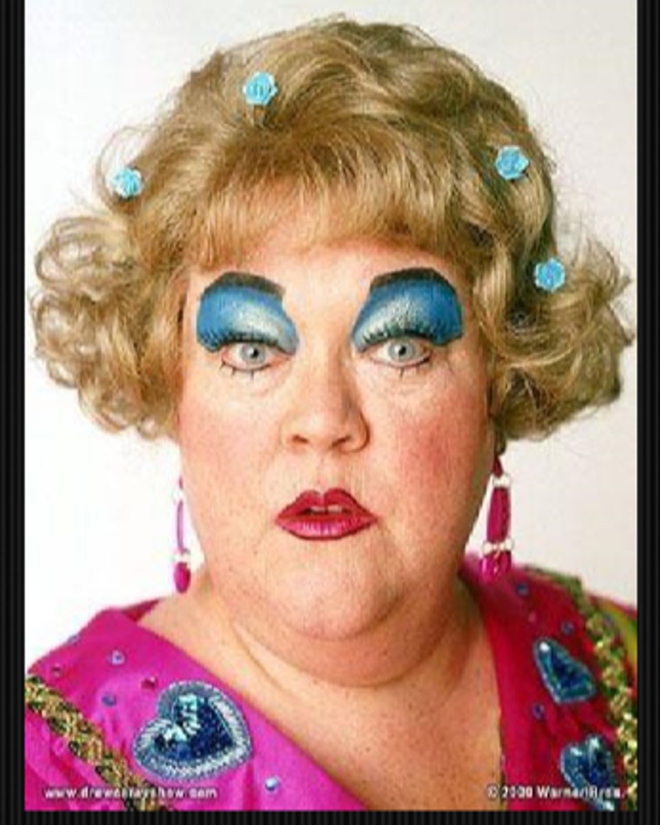 <p>heavy makeup may be covering white lashes (poliosis), loss of lashes/brows (alopecia), skin lesions (Sturge-Weber, nevus of ota, cafe-au-lait spots, sarcoid nodules)</p>