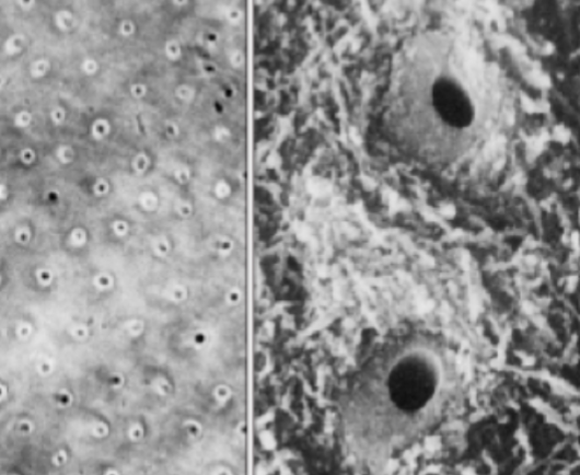 <p>what. type of dentin is between dentinal tubules</p>