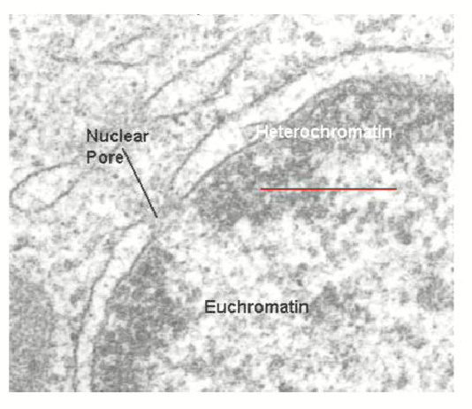 <ol><li><p>Heterochromatin </p></li></ol><ul><li><p>Made up of silenced DNA sequences (transcriptionally inactive) and very densely packed (dark on a micrograph)</p></li></ul><ol start="2"><li><p>Euchromatin</p></li></ol><ul><li><p>Made up of actively transcribing DNA sequences (transcriptionally active) and unwound to provide a transcriptional template</p></li><li><p>delicate</p></li></ul><p></p>