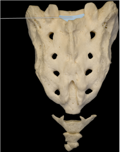 Which opening is highlighted?