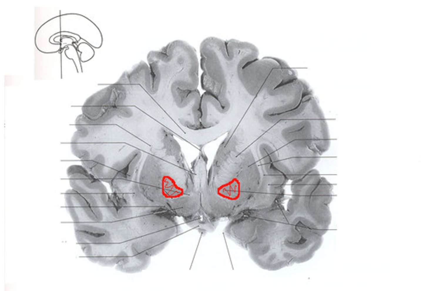 <p>most medial component of the basal ganglia</p>