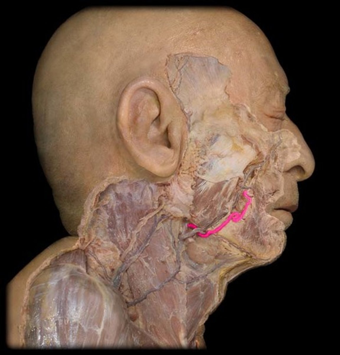 <p>Supplies blood to the glandular tissue and musculature of the face as well as the overlying skin and fascia.</p>