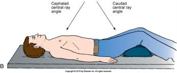 <p>An angle directed towards the feet.</p>