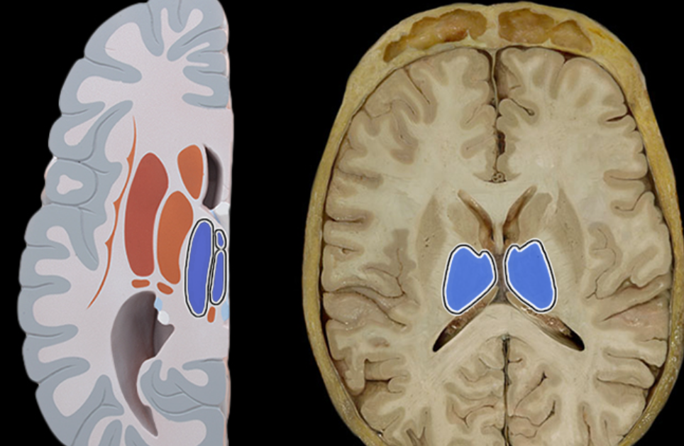 <p>Location:</p><ul><li><p>Diencephalon</p></li></ul><p>Description:</p><ul><li><p>Paired groups of nuclei separated by third ventricle</p></li><li><p>Largest portion of the diencephalon</p></li><li><p>Composed primarily of gray matter</p></li></ul><p>Function:</p><ul><li><p>Primarily for relay of sensory information to cortex</p></li><li><p>Relay of motor information for movement planning</p></li></ul><p></p>