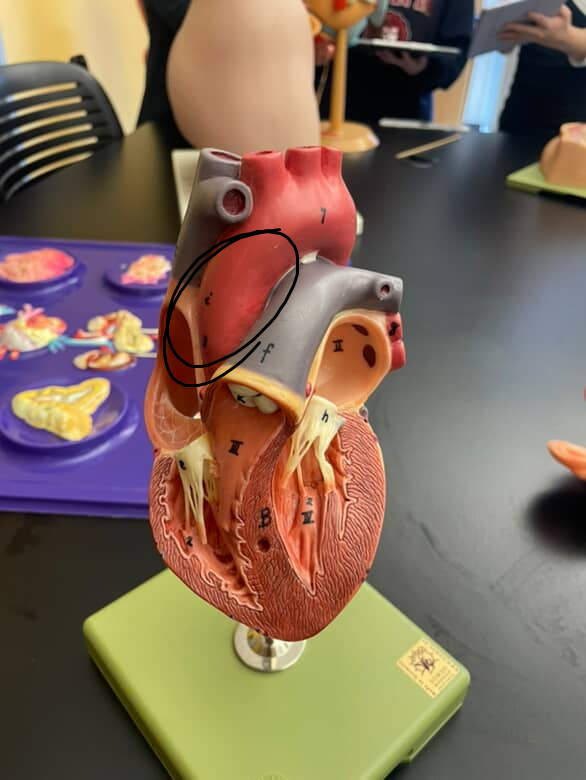 <p>the “left side” of the aortic arch, coming up directly from the heart</p>