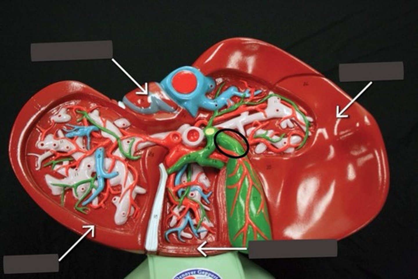 <p>Branches from common bile duct</p>