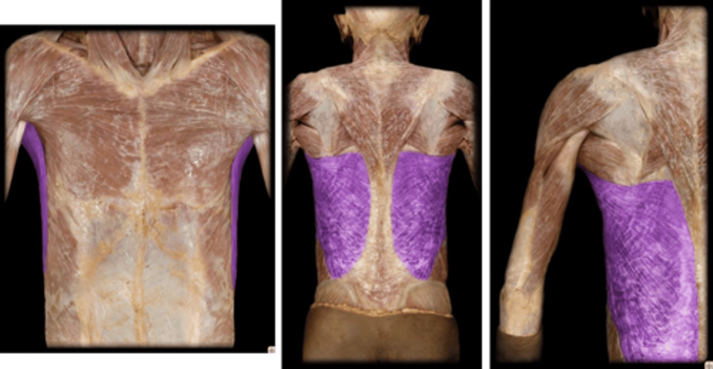 <p>What is the name of this muscle, highlighted in purple?</p>