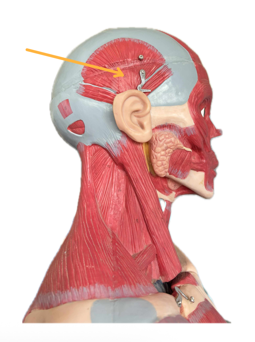 term image