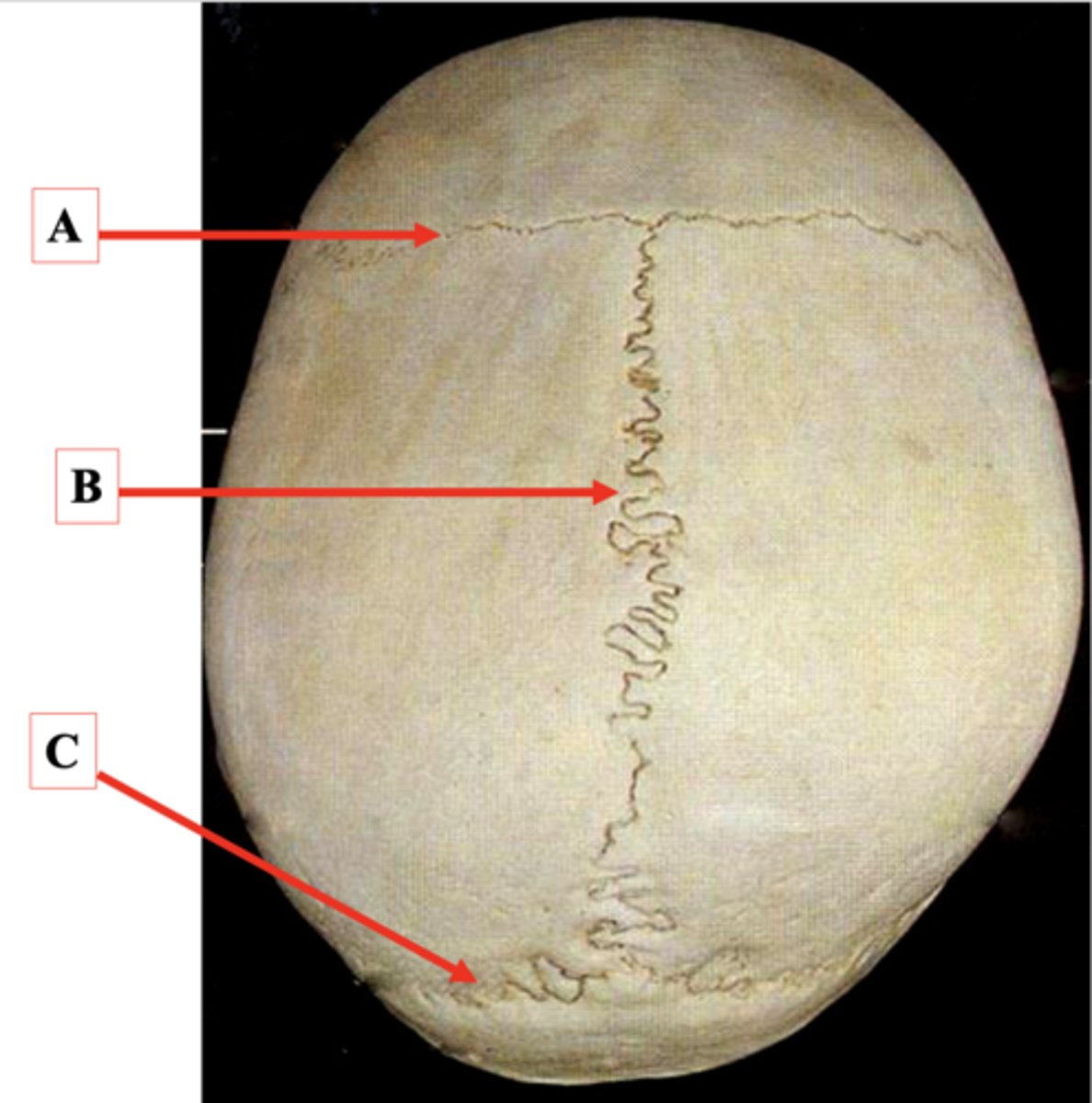 <p>Identify A.</p>