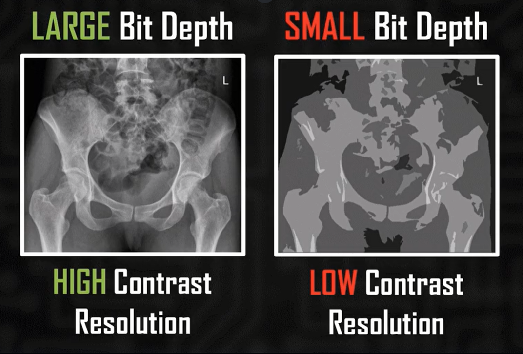 <p>contrast resolution </p>