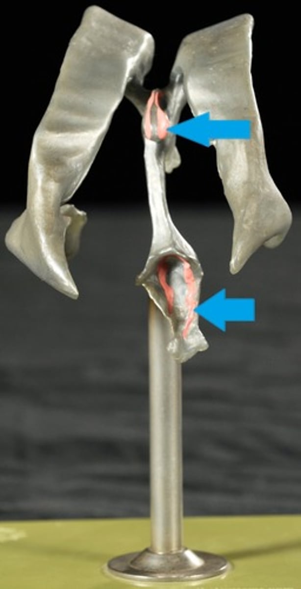 <p>Forms Cerebrospinal Fluid</p>