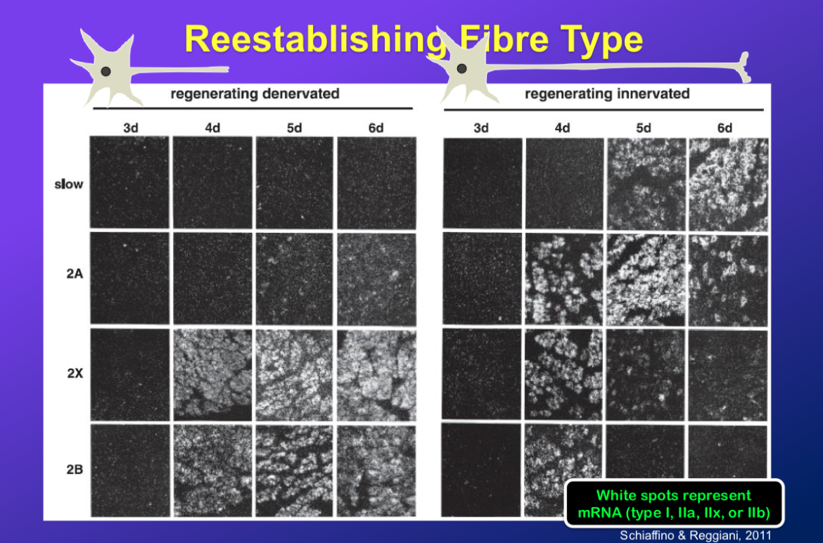 <p>-so basically the nerve was NOT intact with the muscle while it was regenerating</p><p>-we see similar response at beginning, where at first there is expression of embryonic MHC and then then transition to type 2, but they DONT further transition to type 1, so kind of stay at fast glycolytic type 2x/b</p><ul><li><p>basically means without innervation, it stays at type 2 composition</p></li></ul><p>-this is in soleus, so mostly type 1 anyway, so nerve makes it go to type 1 over the tendency to stay at type 2</p>