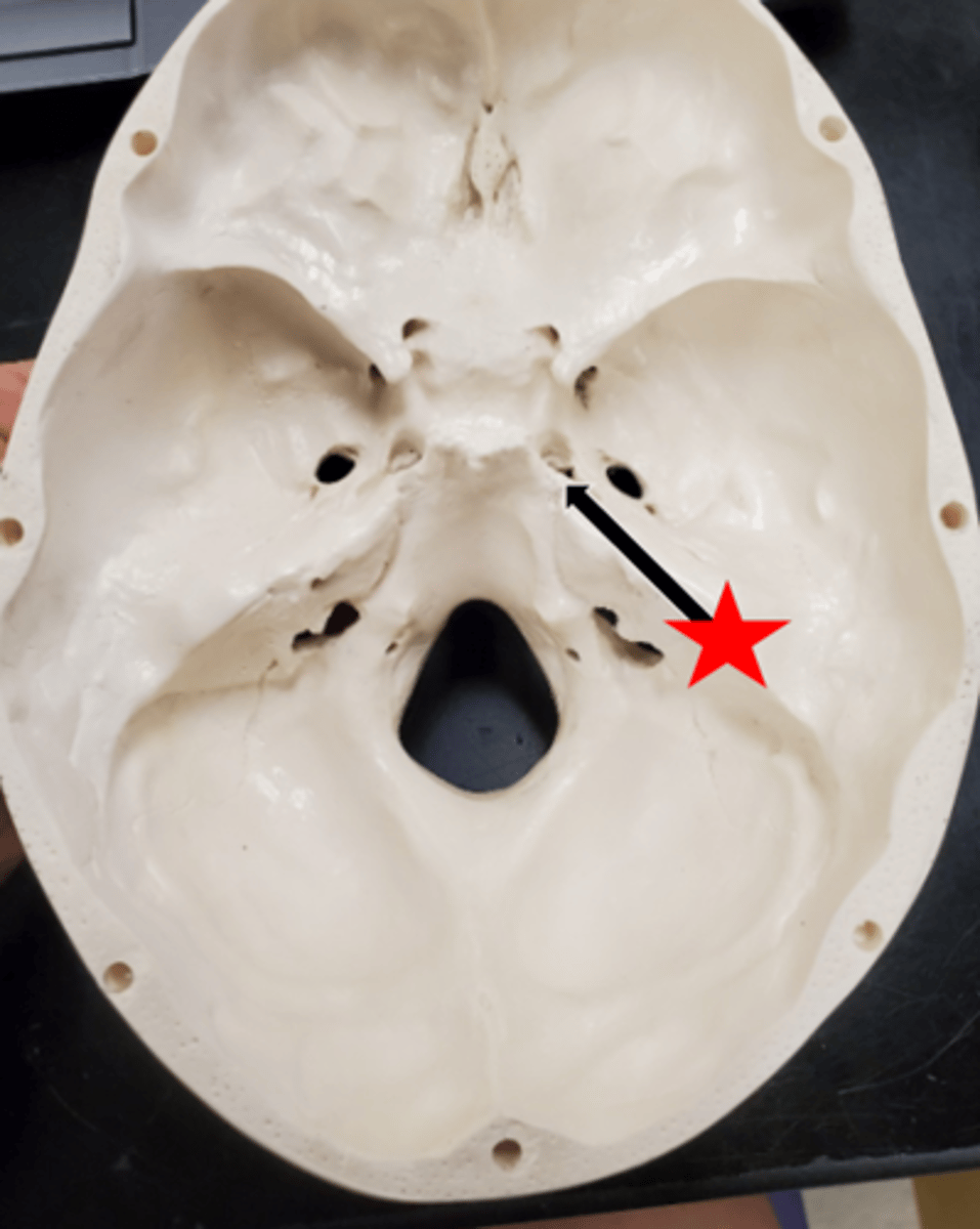<p>Name the starred region in the image.</p>