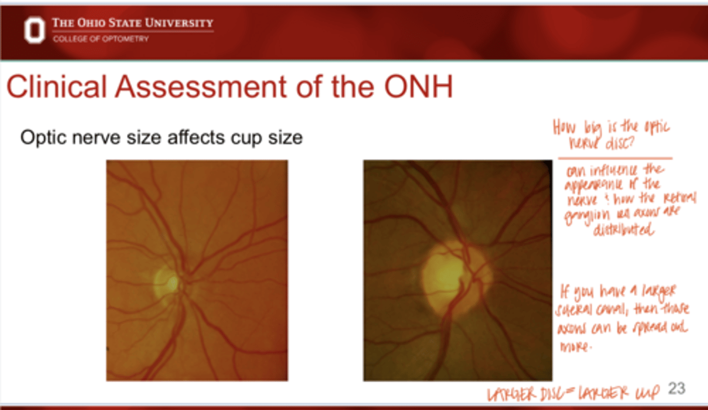 <p>True or False: </p><p>Optic nerve size will affect cup size</p>