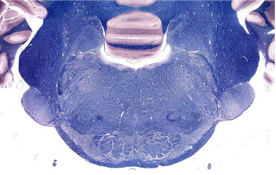 <p>what section of the brain is shown?</p>