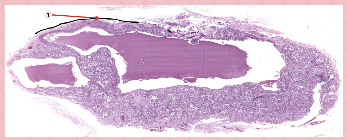 <p>Identify the structure labeled as 1.</p>
