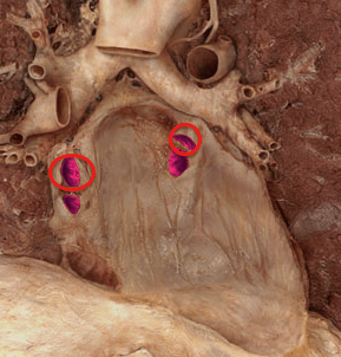 <p>Name the Structure of the Left Atrium</p>