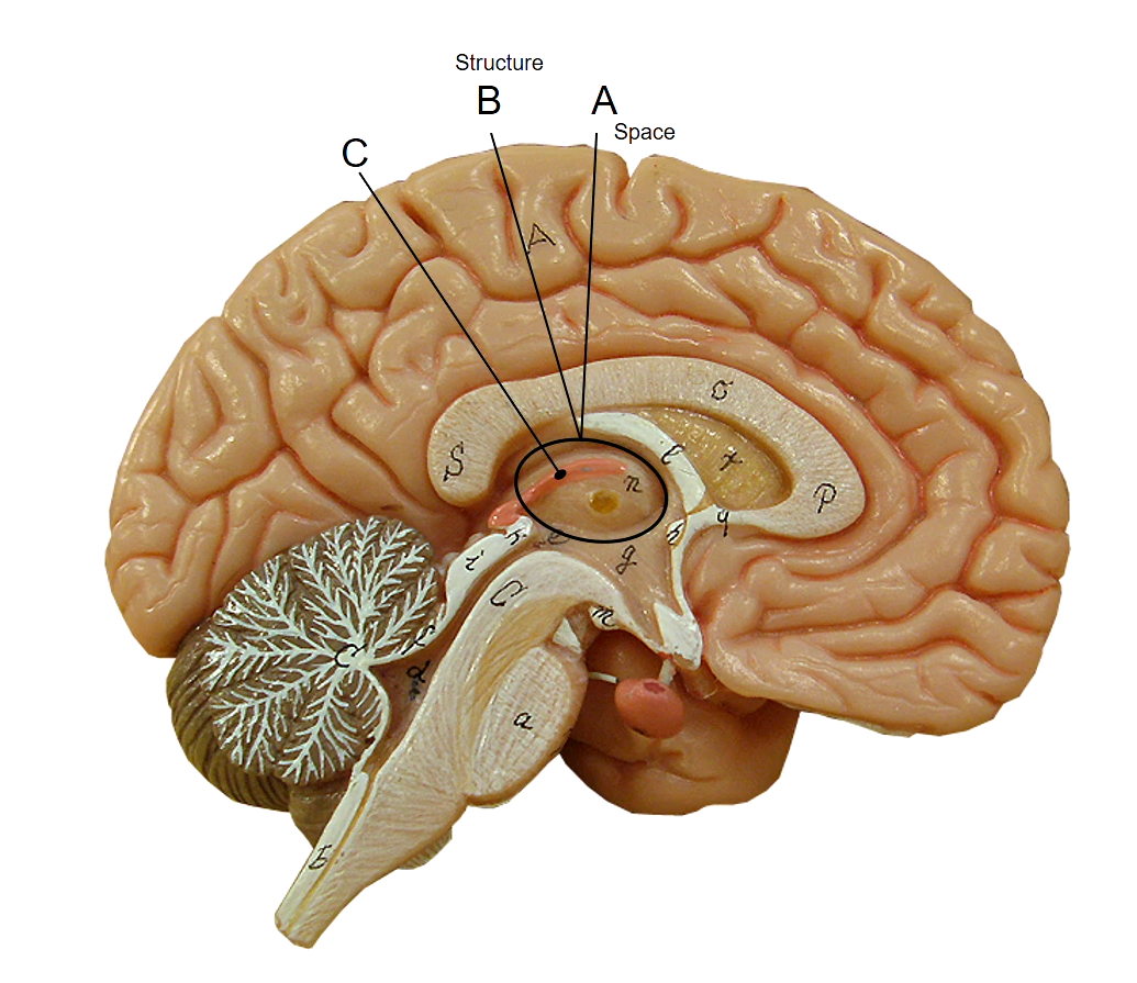 <p>C</p>