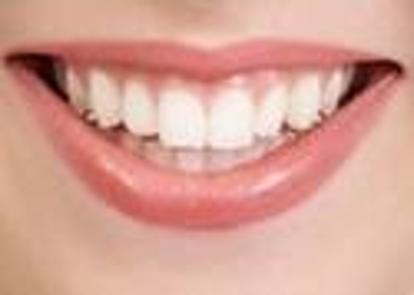 <p>the teeth</p>