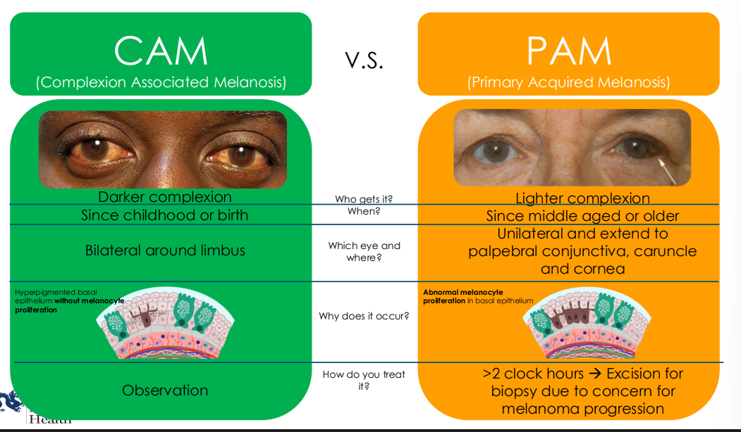 <ol><li><p>CAM</p><ol><li><p>darker complexion</p></li><li><p>since childhood or birth</p></li><li><p>bilatral around limbus</p></li><li><p>no melanocyte proliferation</p></li><li><p>observe</p></li></ol></li><li><p>PAM</p><ol><li><p>lighter complexion</p></li><li><p>since middle aged or older </p></li><li><p>unilateral and can extend to palpebral conj, caruncle, cornea</p></li><li><p>abnormal melanocyte proliferation</p></li><li><p>treat if &gt;2 clock hours —&gt; biopsy for concern of melanoma</p></li></ol></li></ol><p></p>