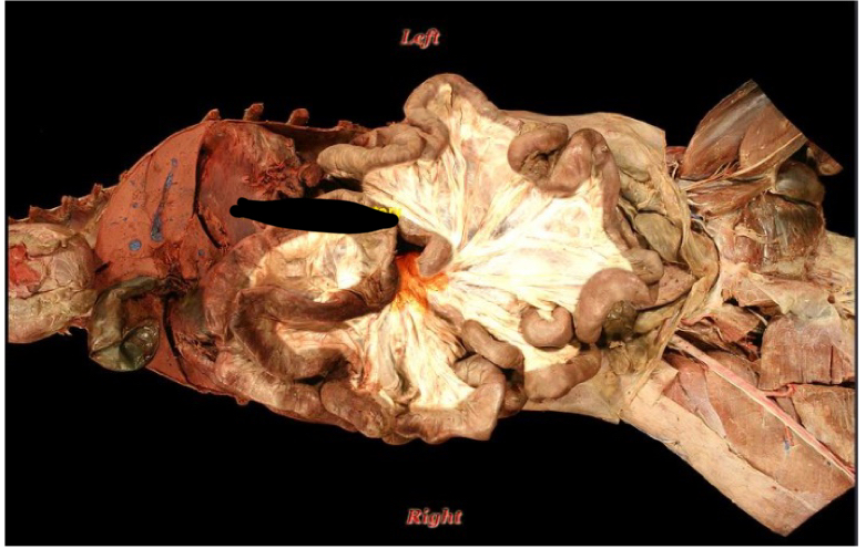 term image