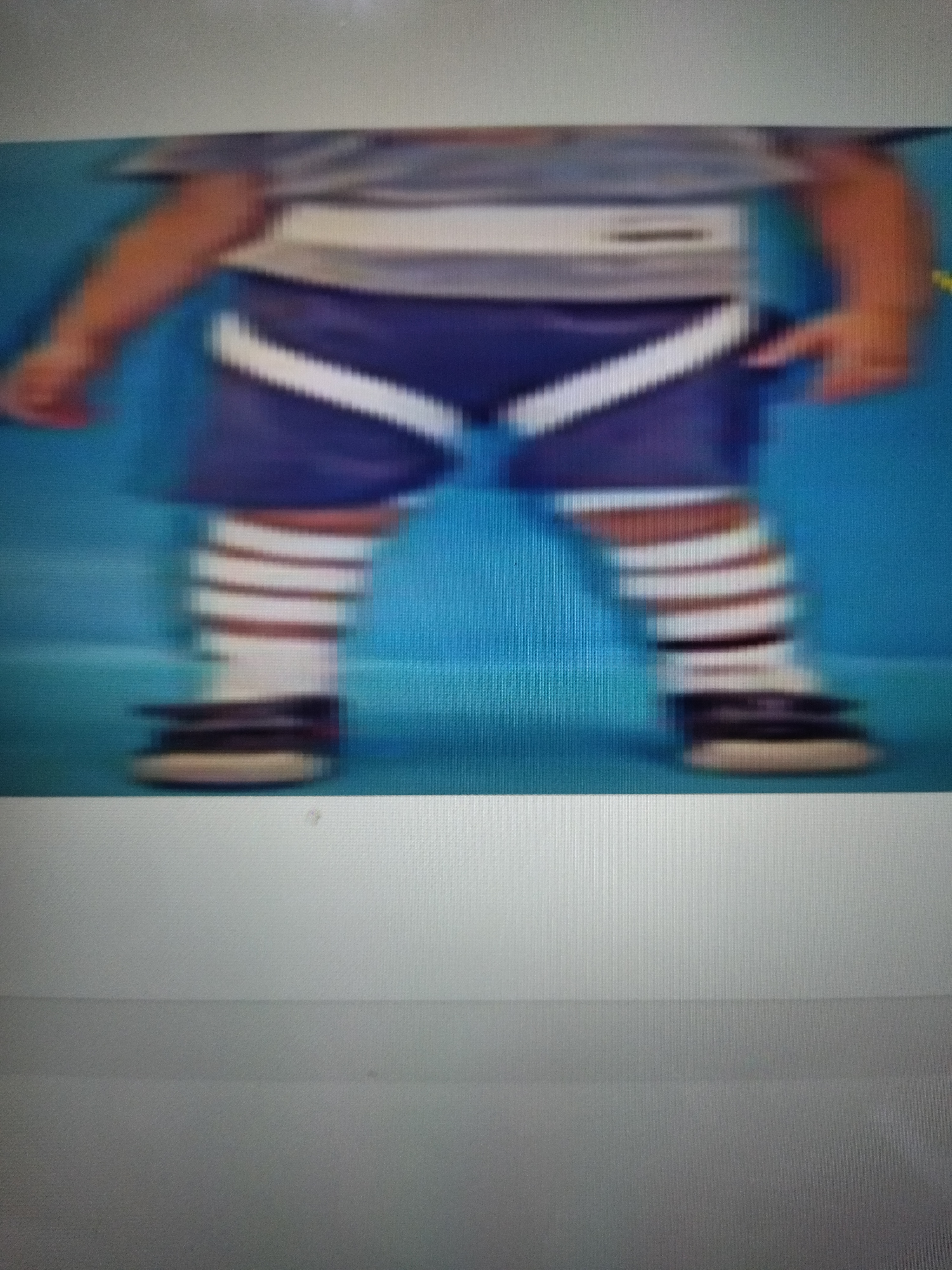 * Has hip rotation control straps for rotation control


* Used for pt. c spastic hemiplegia, abnormal in/out toeing