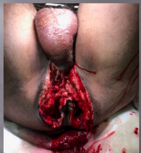 <p>What injury is this?</p>