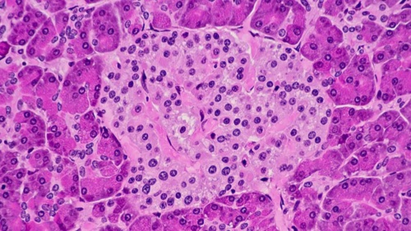 <p>mixed gland. Islet of Langerhans (shown) with Alpha Cells that secrete Glucagon and Beta Cells that secrete Insulin (endocrine)</p>
