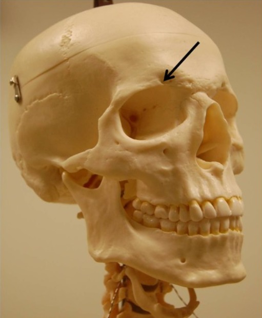 <p>Name this foramen.</p>