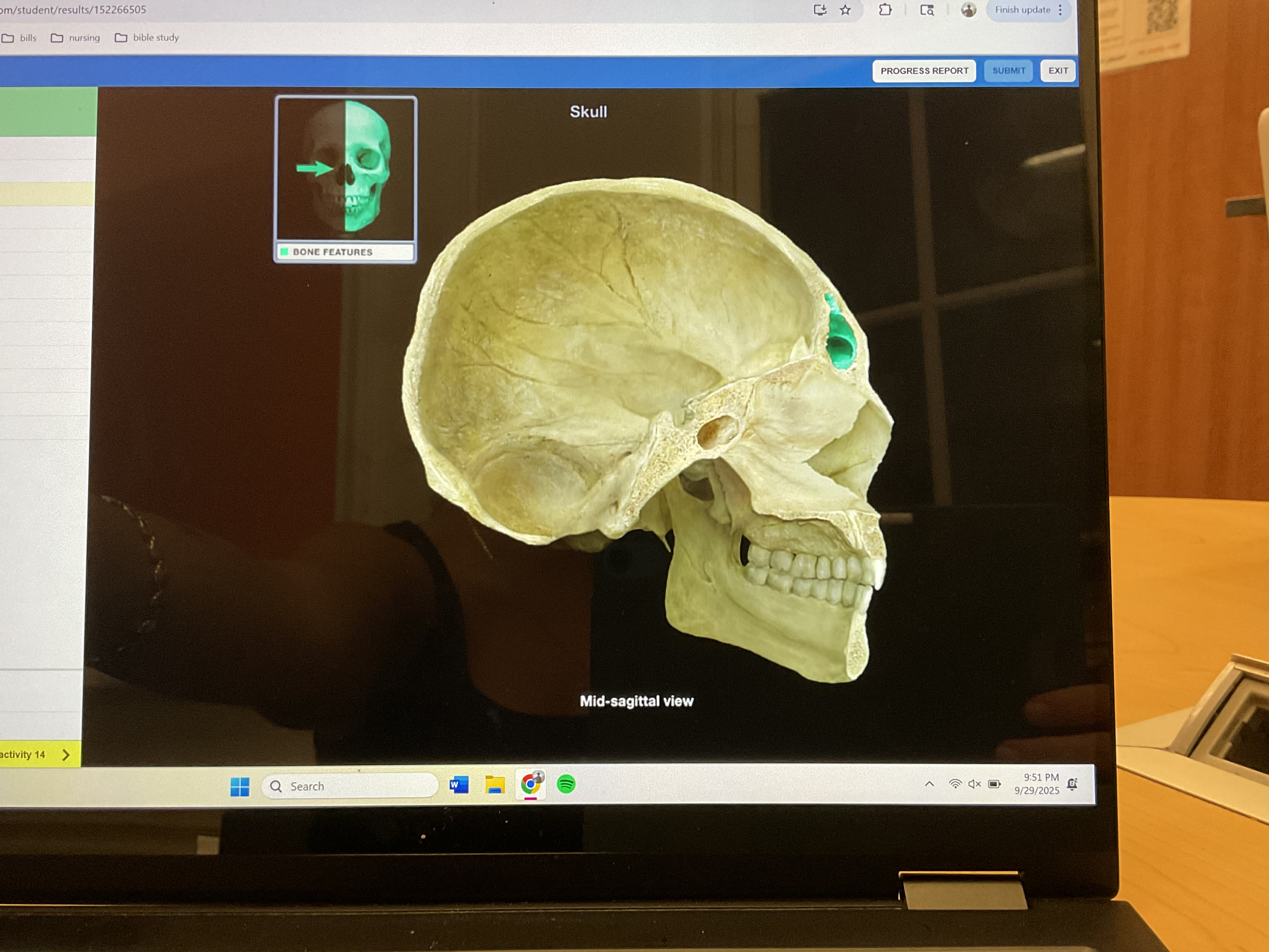 <p>Frontal sinus </p>