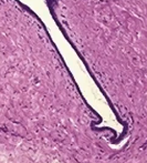 <p>Breast</p>