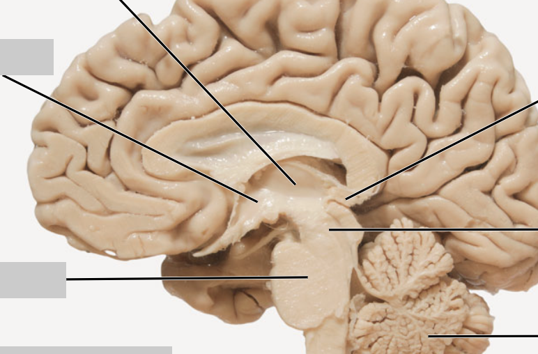 <p>label structures on midsagittal section of brain</p>
