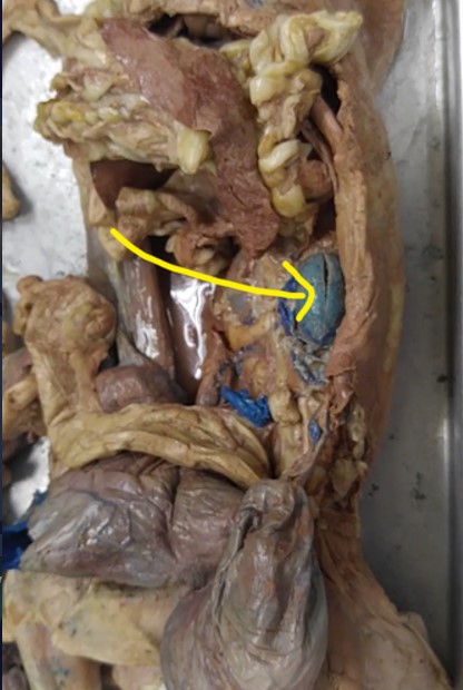 <p>What organ is indicated by the yellow arrow?</p>