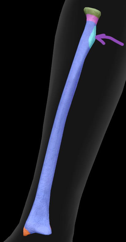 term image