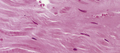 <p>what type of fibres are shown here </p>