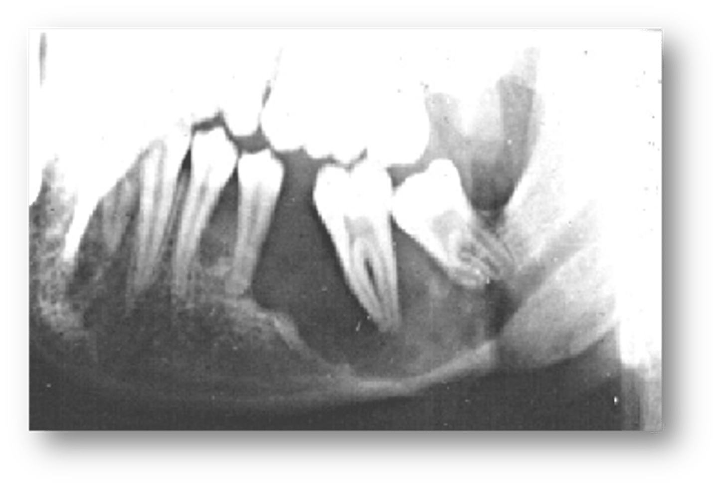 <p>ID the pathology:</p>