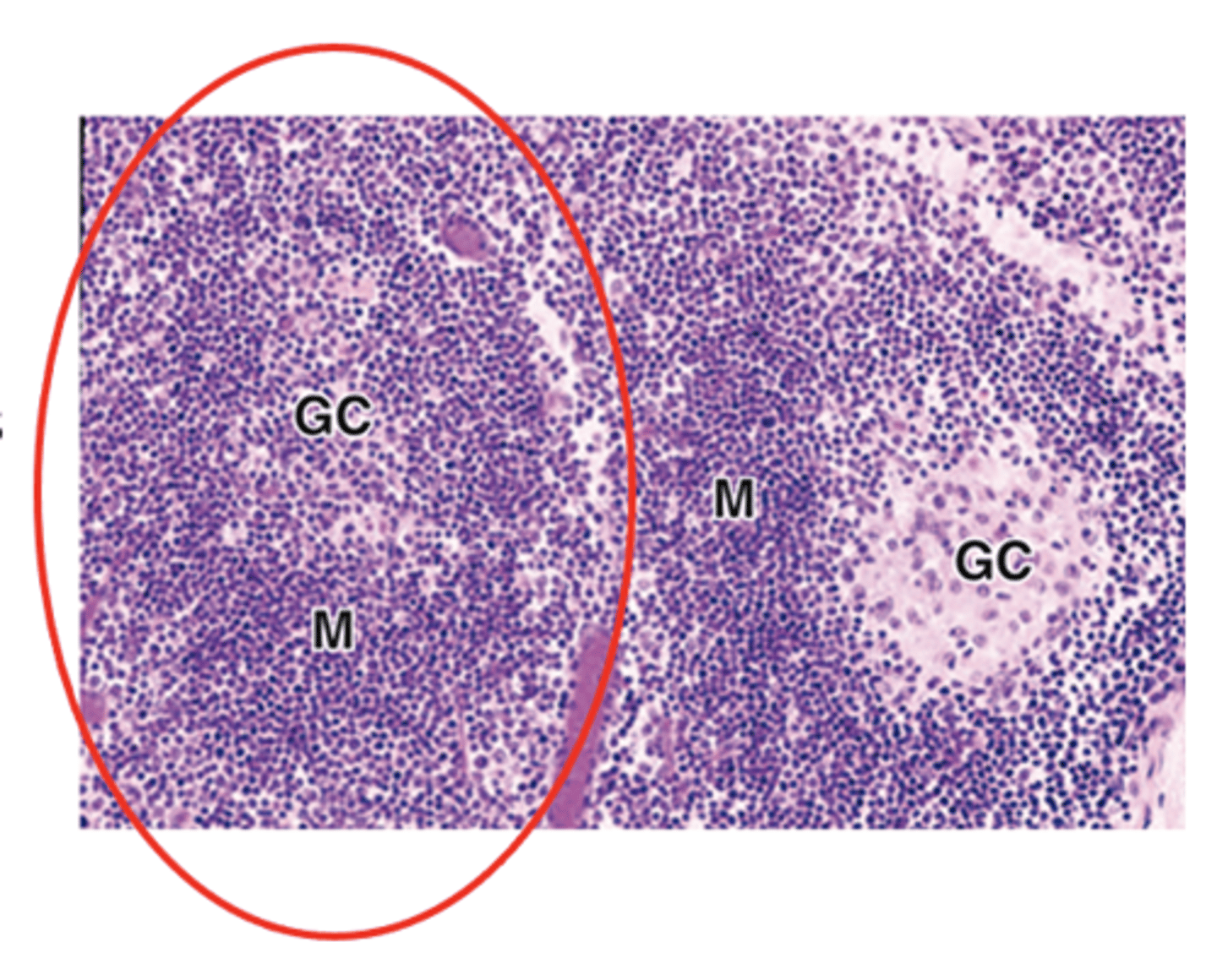 <p>What is a primary lymphoid nodule?</p>