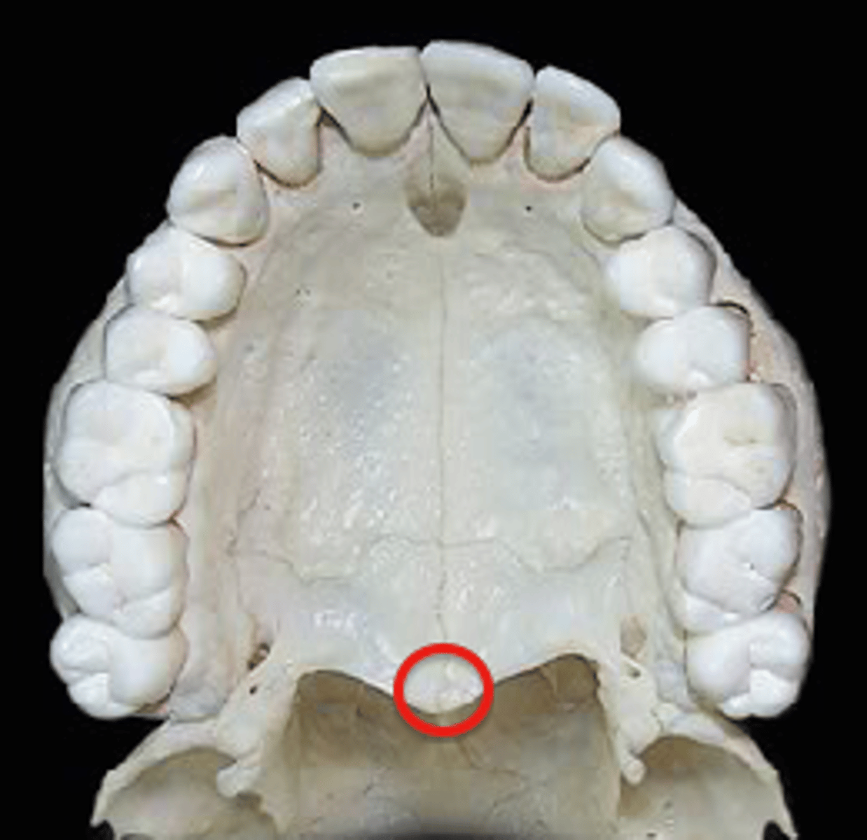 <p>Pointed bony projection at the posterior end of the hard palate.</p>