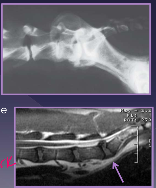 <ul><li><p>differentials </p><ul><li><p>neoplasia </p></li><li><p>hip dysplasia </p></li><li><p>degenerative myelopathy </p></li></ul></li><li><p><strong>elicit pain on examination - tail raise </strong></p></li><li><p>varying degrees of nerve deficits </p><ul><li><p>sacral, caudal, sciatic nerves </p></li></ul></li><li><p>LMN (L4-S3) </p></li><li><p>abnormal perineal sensation </p></li><li><p>patellar “pseudohyperreflexia” - exaggerated reflex </p><ul><li><p>sciatic affected, patellar reflex spared - sciatic cant counter the femoral nerve action </p></li><li><p>due to loss of antagonistic muscle action </p></li><li><p>femoral nerve not affected since femoral is higher up </p></li></ul></li><li><p>rectal exam </p><ul><li><p>palpate dorsal/pressure b/c they will show pain also stricture of rectum </p></li></ul></li><li><p>radiographs </p><ul><li><p>spondylosis </p></li><li><p>narrowed disc </p></li><li><p>endplate sclerosis </p></li><li><p>transitional vertebrae </p></li></ul></li><li><p>CT </p></li><li><p>MRI - way to go but CT will work </p></li></ul><p></p>