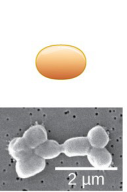 <p>What type of bacteria is this?</p>