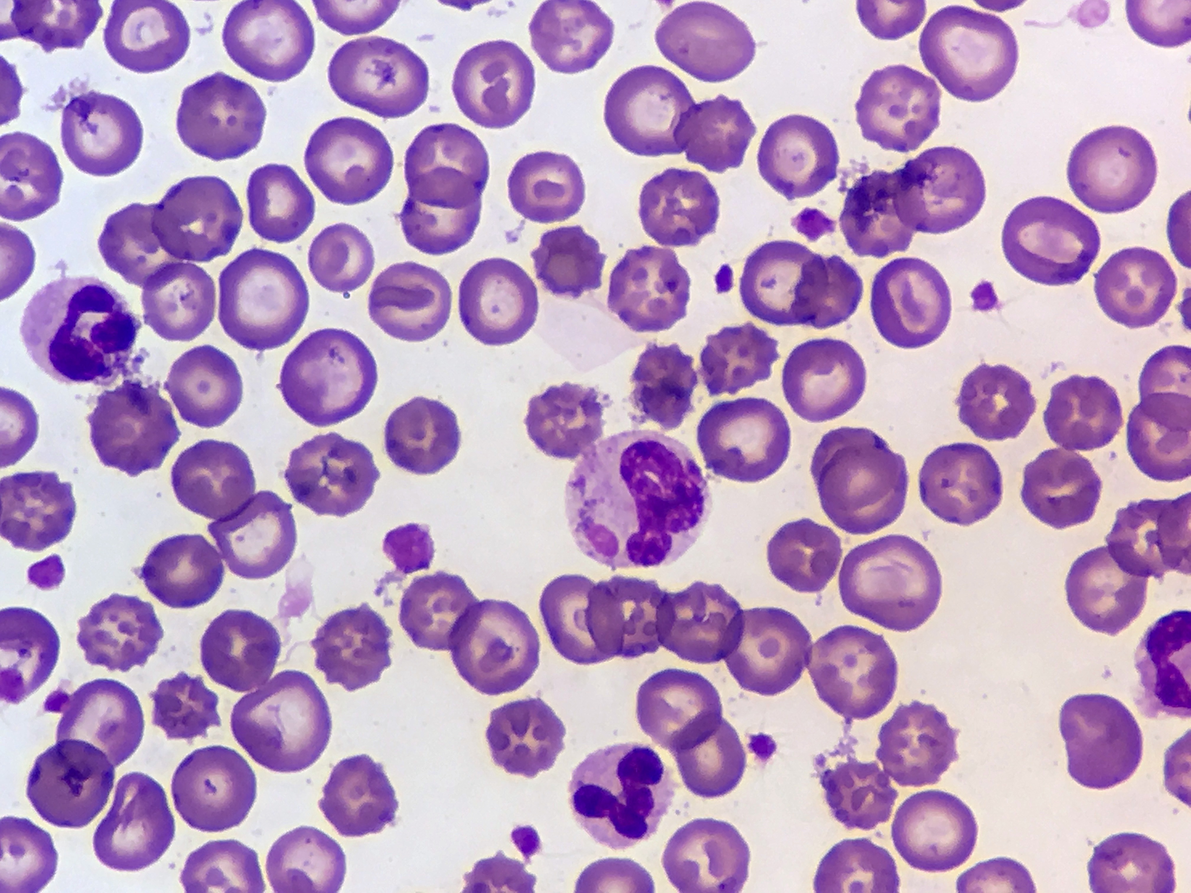 <p>Inclusion bodies (Granules)</p>