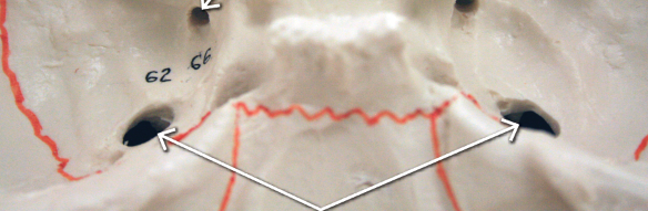 <p>bottoms arrows </p>