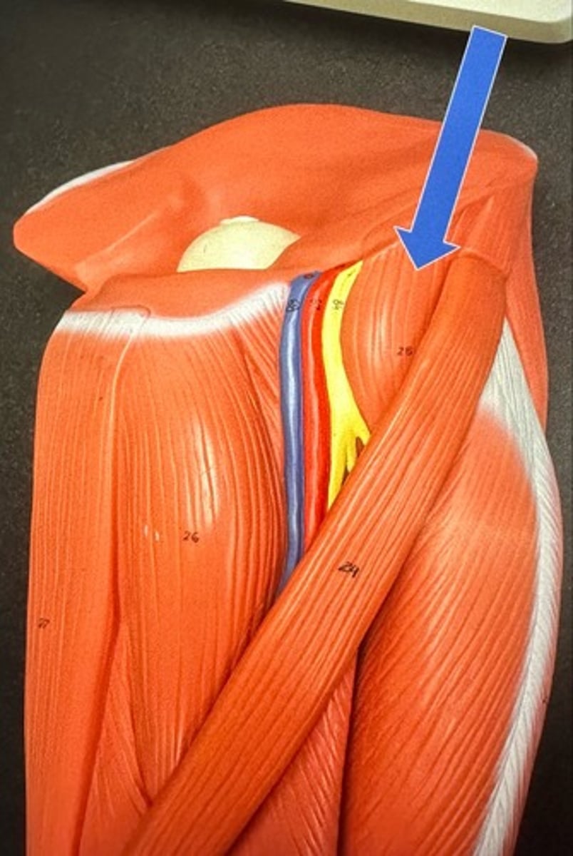 <p>Iliopsoas</p>