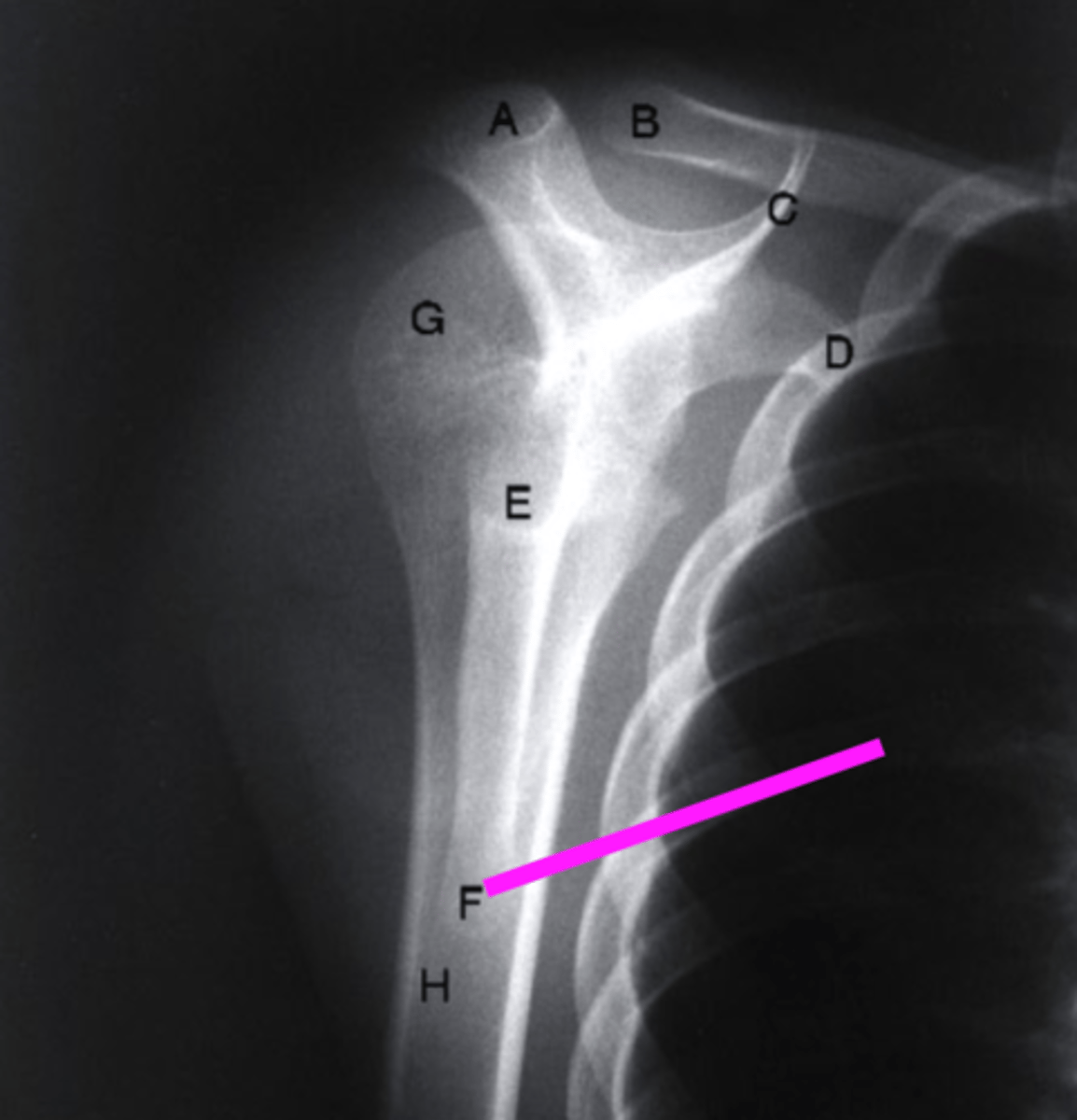 <p>what does the pink line point to?</p>